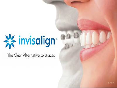 Invisalign